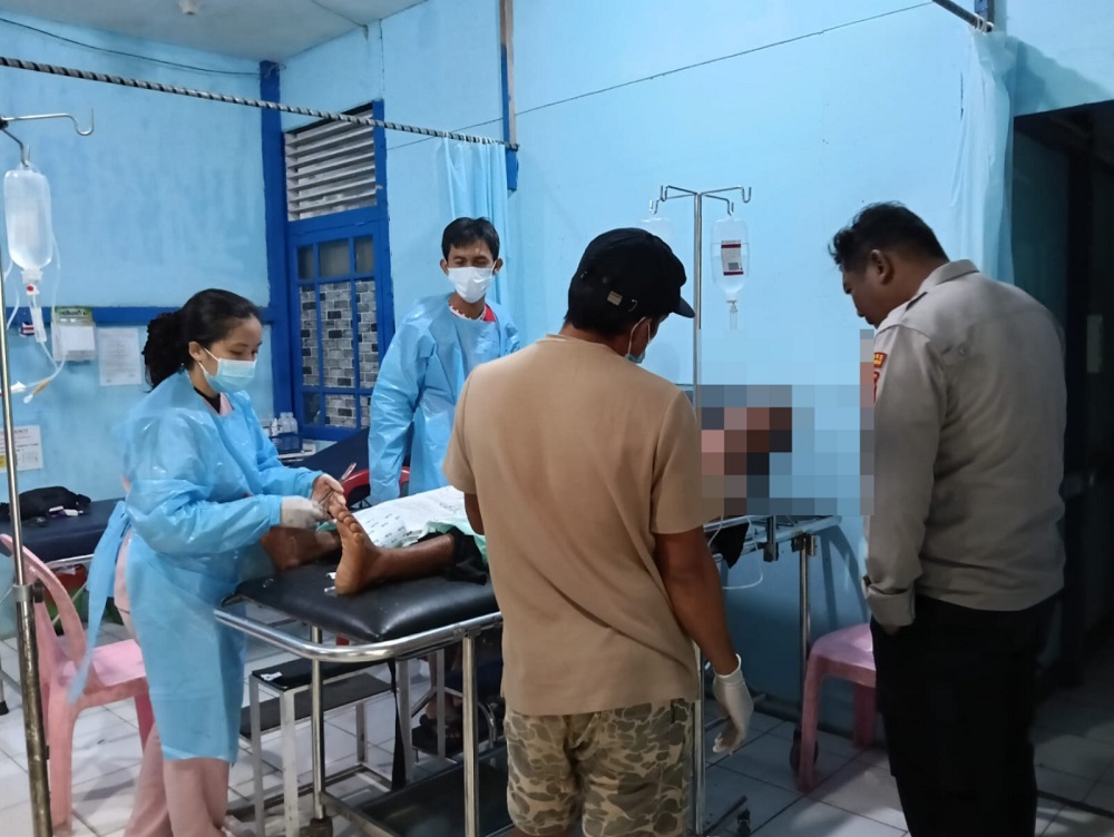 Polisi Buru Pelaku Curas di Kapuas Hulu, Korban Alami Luka Bacok dan Motor Dibawa Kabur